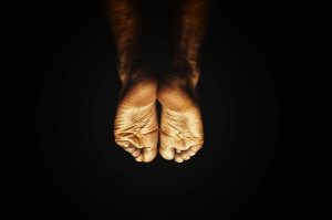 Feet - Keeping Your Feet Healthy with Diabetes
